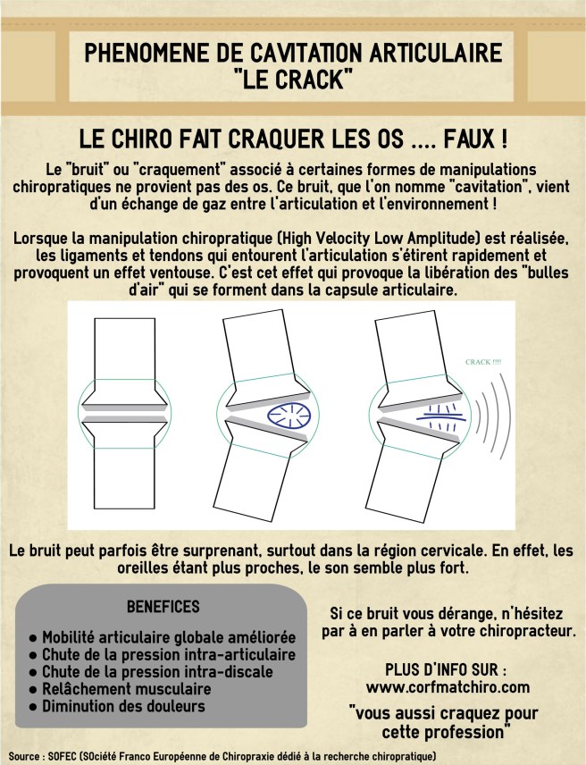 cavitation infographie
