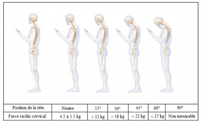 text-neck-jpg-662x0_q70_crop-scale